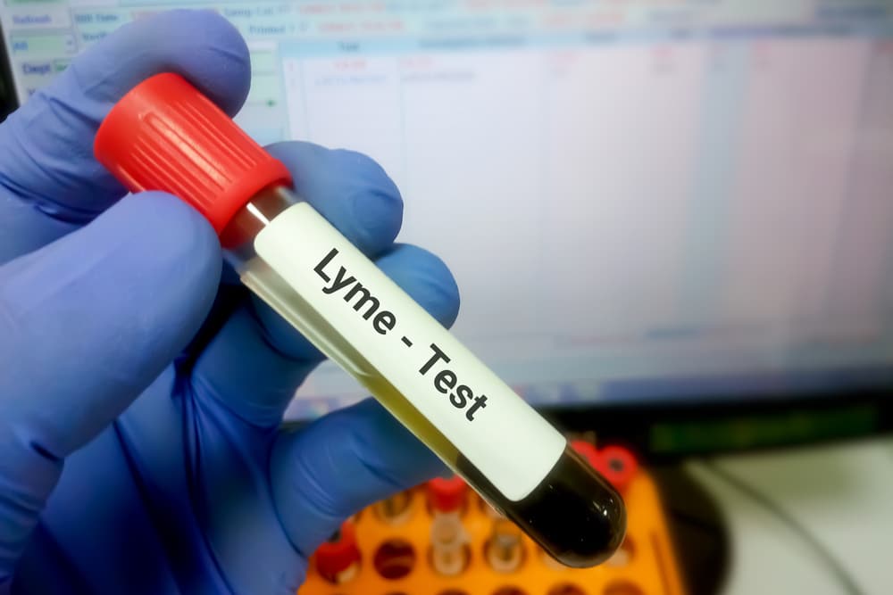 Veterinarian performing a Lyme disease test to diagnose tick-borne illness in a dog using a veterinary blood sample.